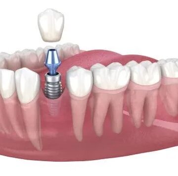 Как выбрать идеального стоматолога: ключевые критерии