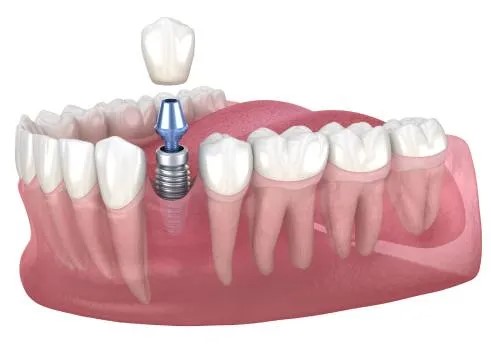 Как выбрать идеального стоматолога: ключевые критерии